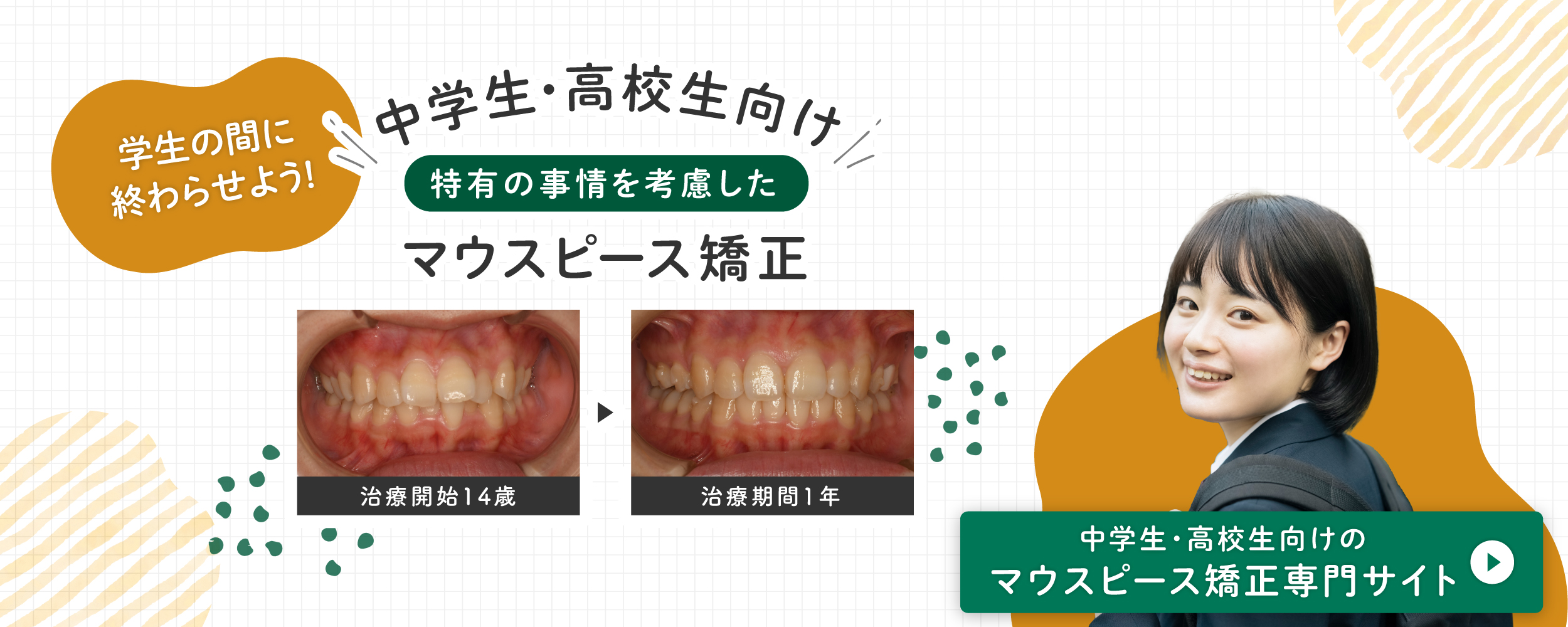 中高生向けのマウスピース矯正専門サイト